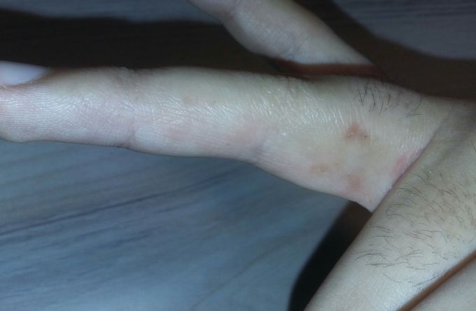Diagnosis?