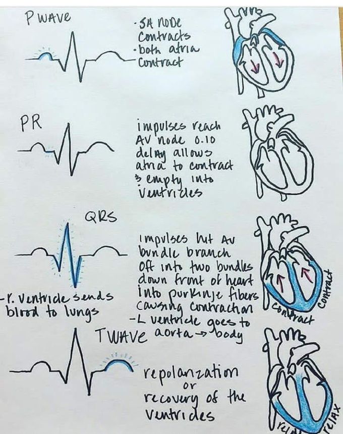 ECG wave