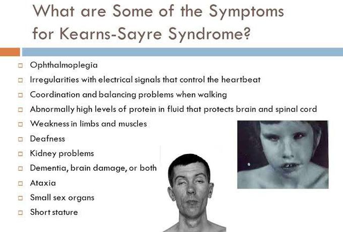These are the symptoms of Kearns-sayre syndrome