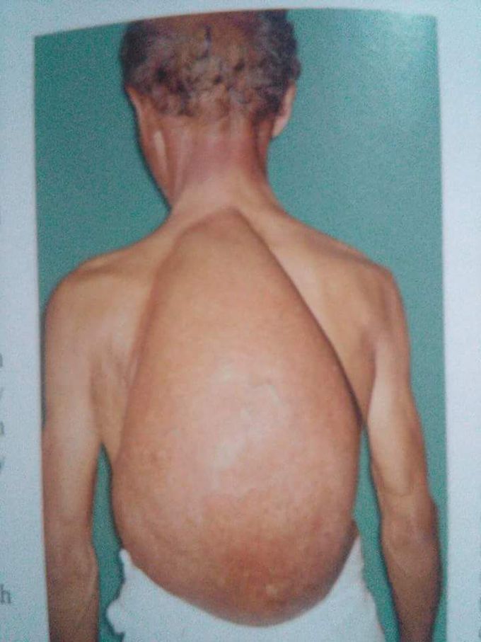 what is the name of this disease