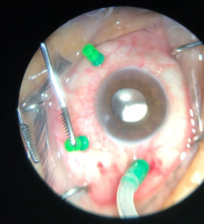 Surgery