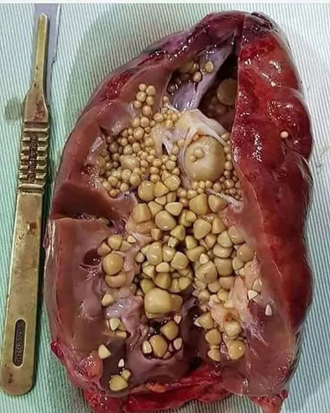 which is your diagnosis??? 🤔🤔