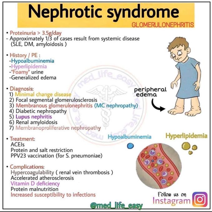 Nephrotic syndrome