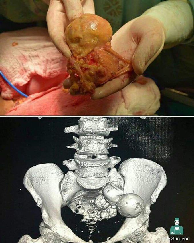 An amazing case !
