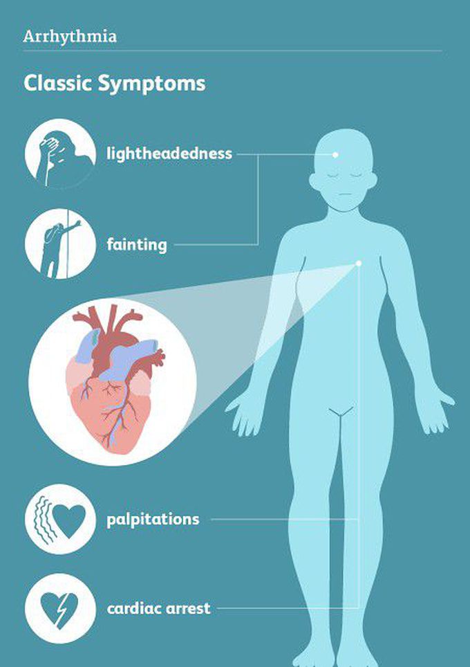 Symptoms of arrhythmias