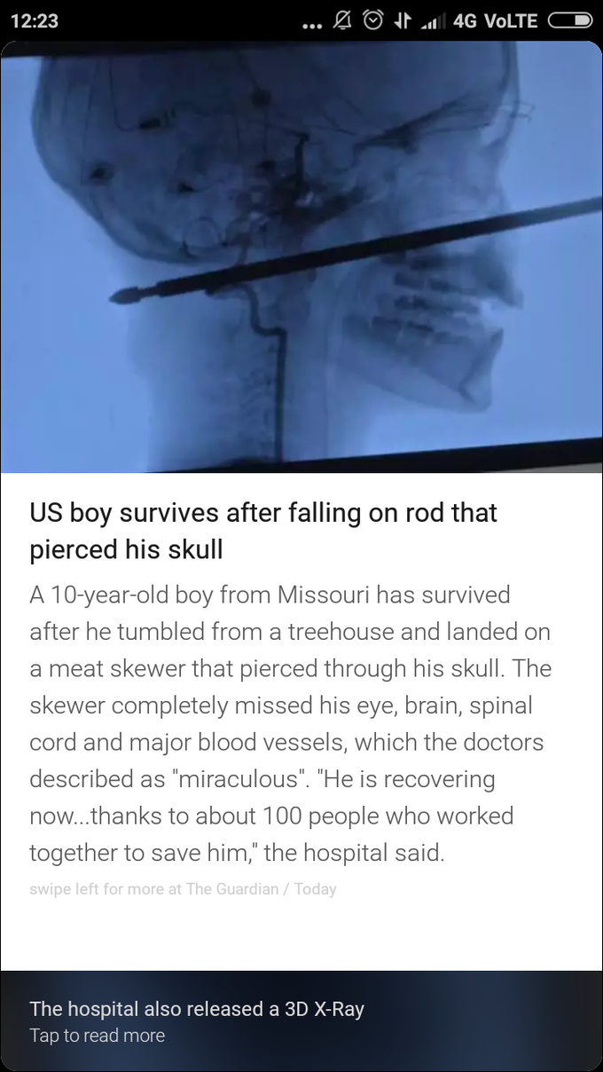 Miracle