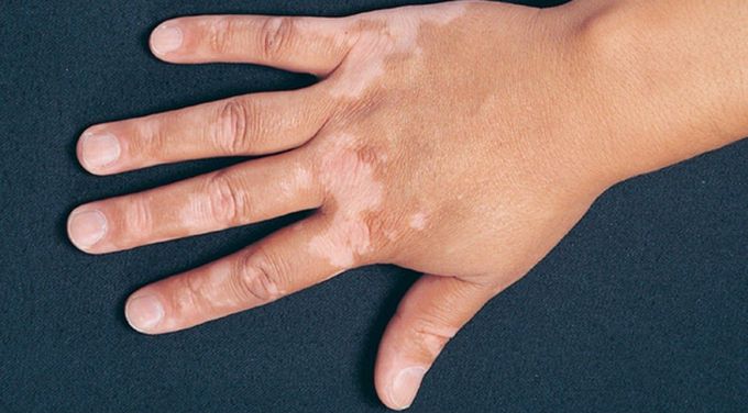 What's your diagnosis?