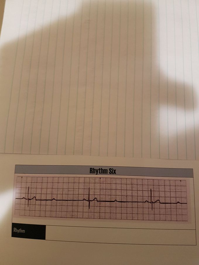 Cardiac
