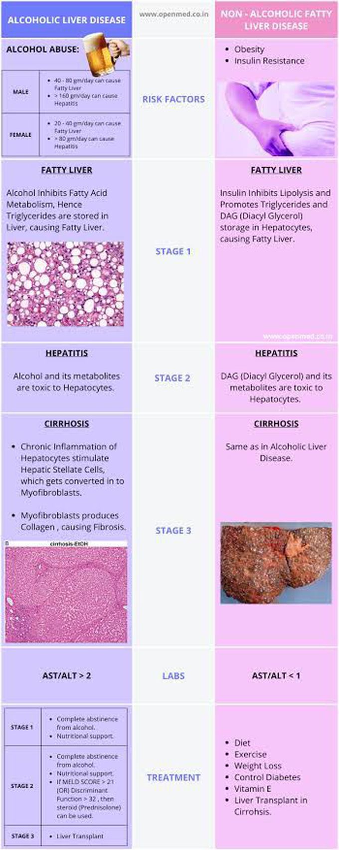 Alcoholic Liver Disease vs Non-alcoholic Liver Disease