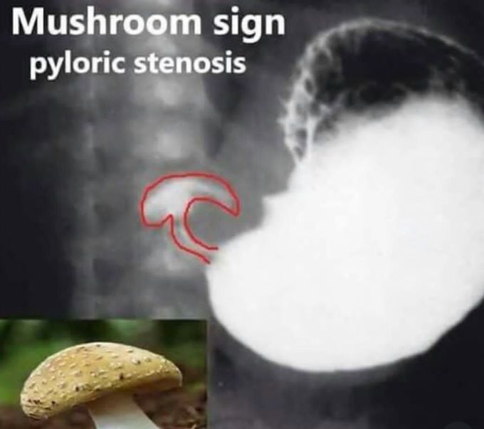 Mushroom Sign