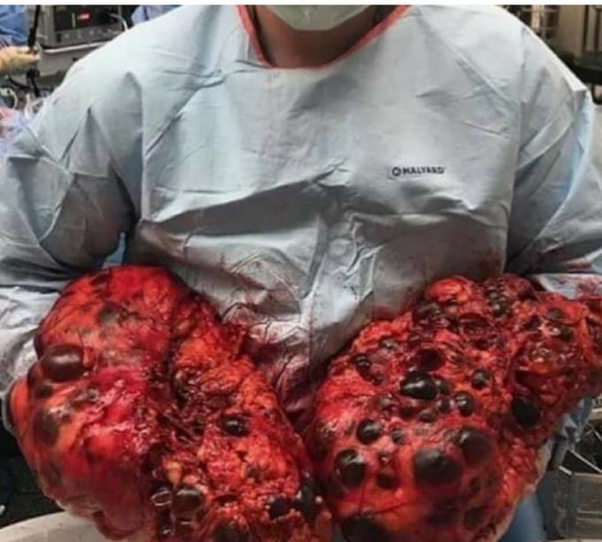 What is your diagnosis ??