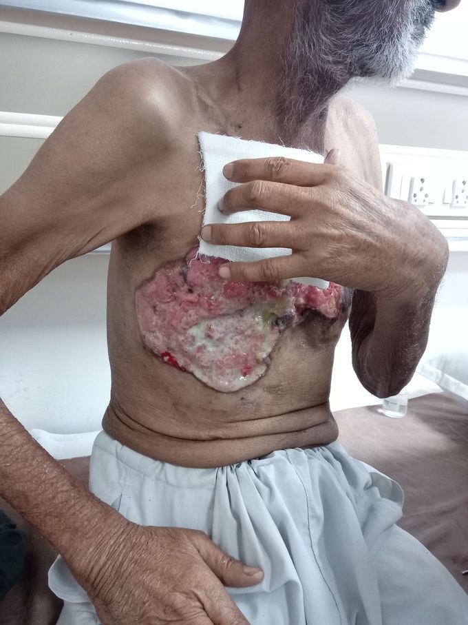 Find out the disease