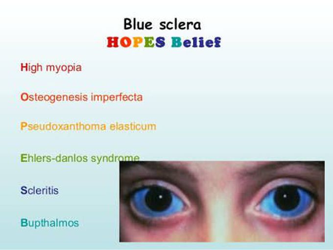 Blue eyes
