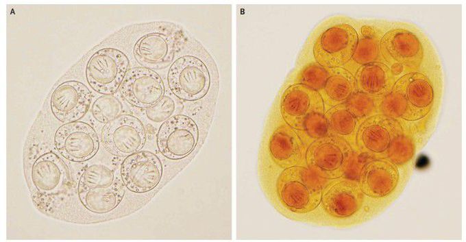 Dipylidium caninum Infection