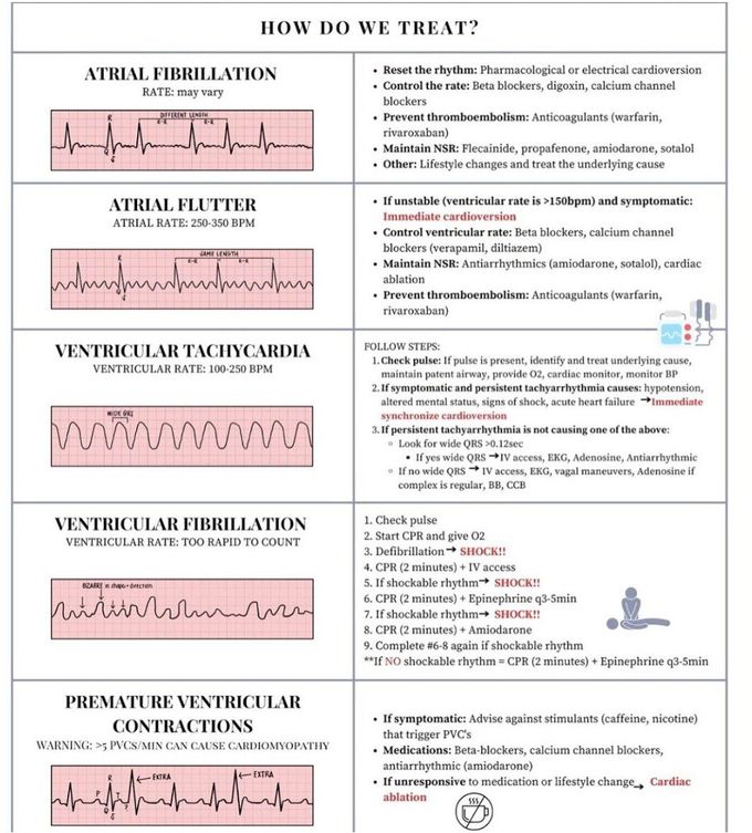 How to treat ECG Changes?