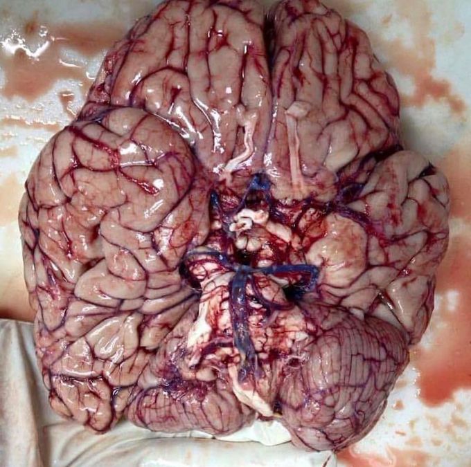 The base of the brain