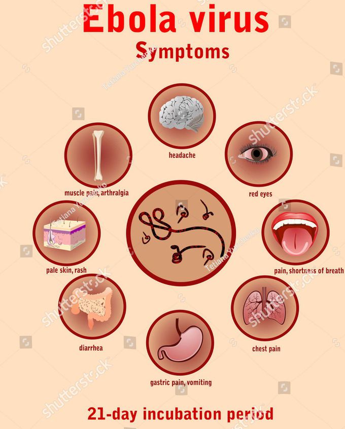 Ebola virus disease