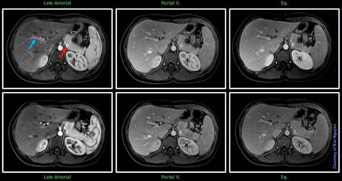 MR Abdominal Imaging