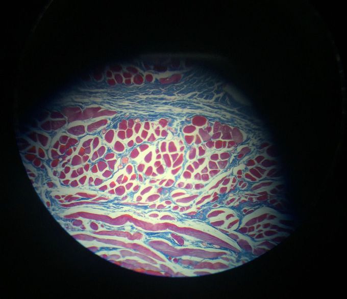 Striated Skeletal Muscle