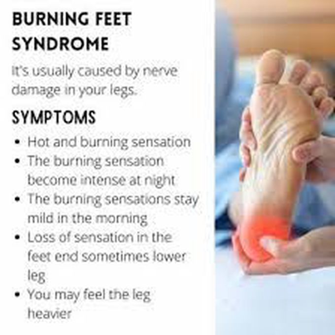 These are the symptoms of Burning feet syndrome
