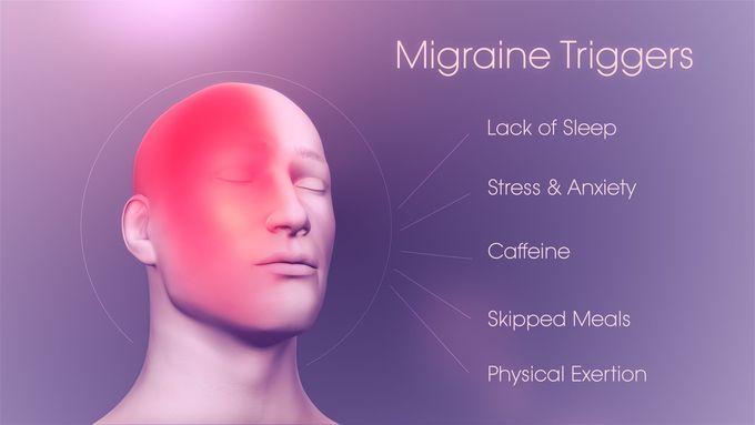 Cause of Migraine