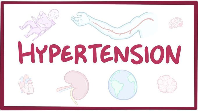 Hypertension