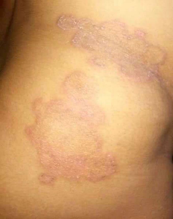 Dx & Rx?