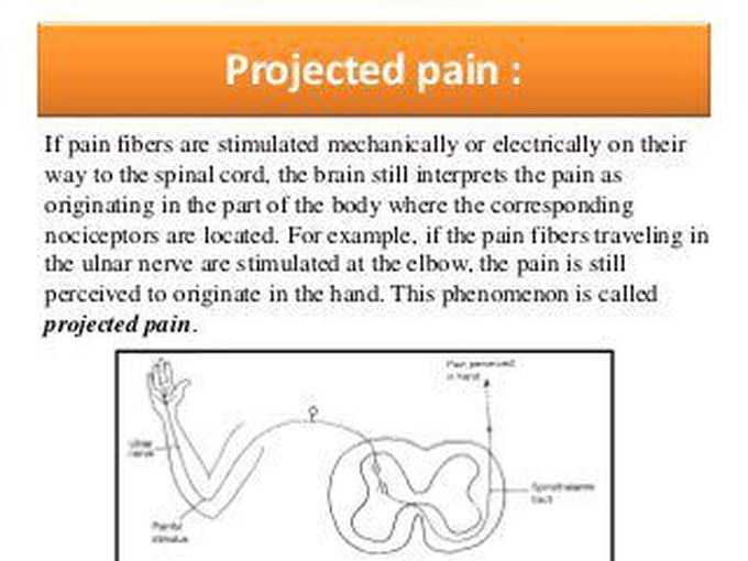 Projected pain