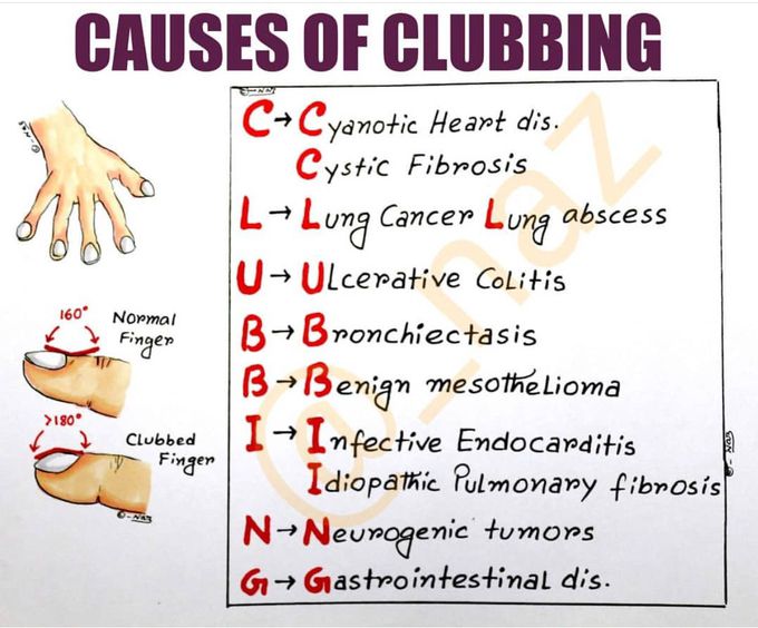 Medical mnemonic