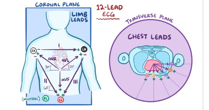 12 Lead ECG
