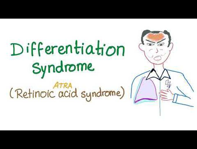 Differentiation Syndrome (formerly, Retinoic Acid Syndrome)