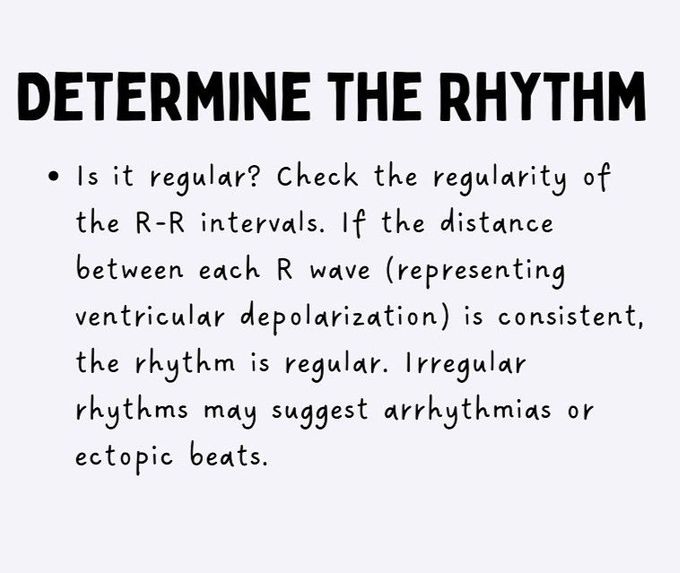 How to Read ECG- II