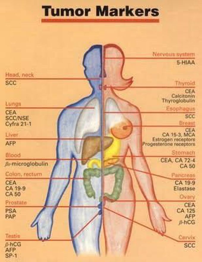 Tumor makers - MEDizzy