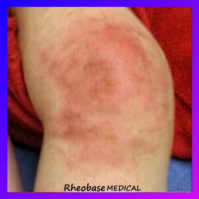 Can you diagnose it?