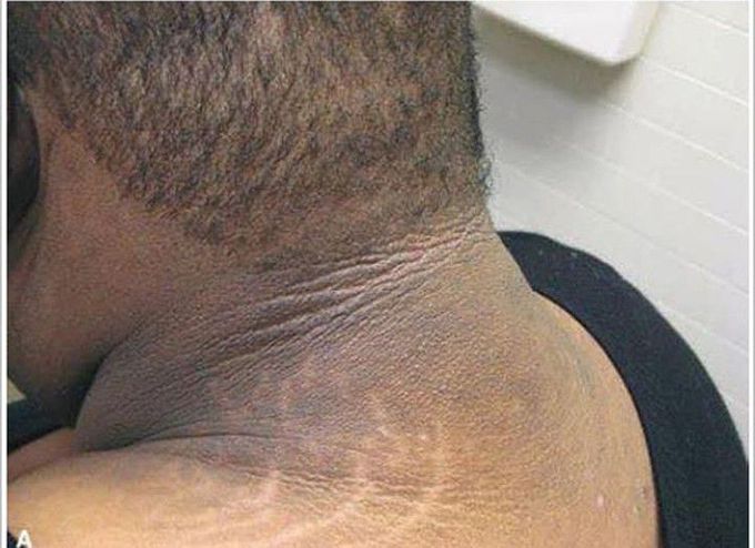 Diagnosis??