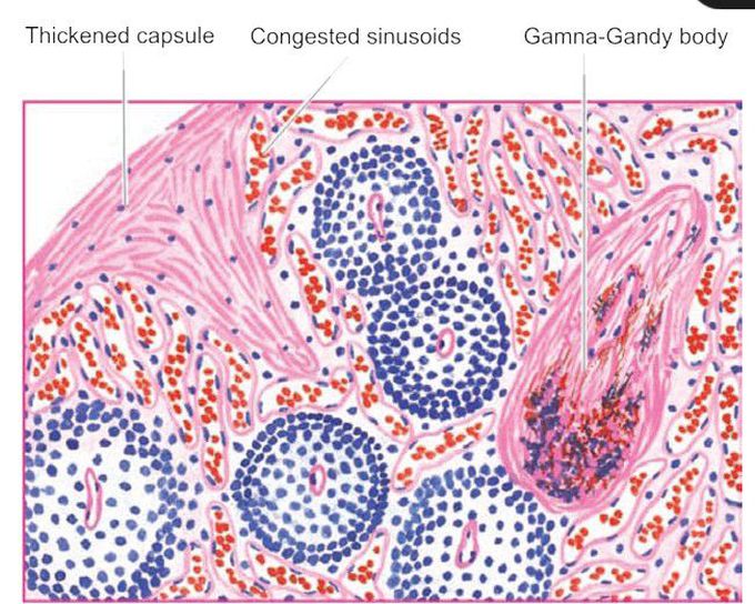 CVC spleen