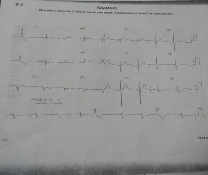 Cardiology case