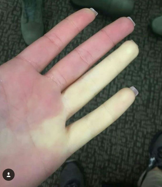 Diagnosis??