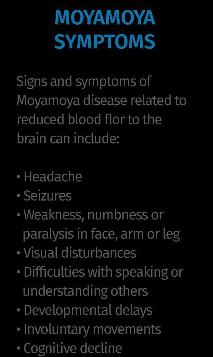 These are the symptoms of Moyamoya syndrome