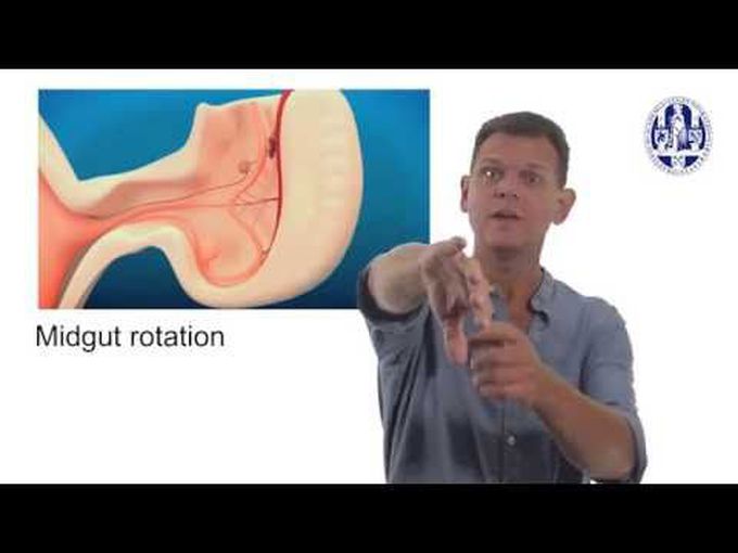 Rotation of gut