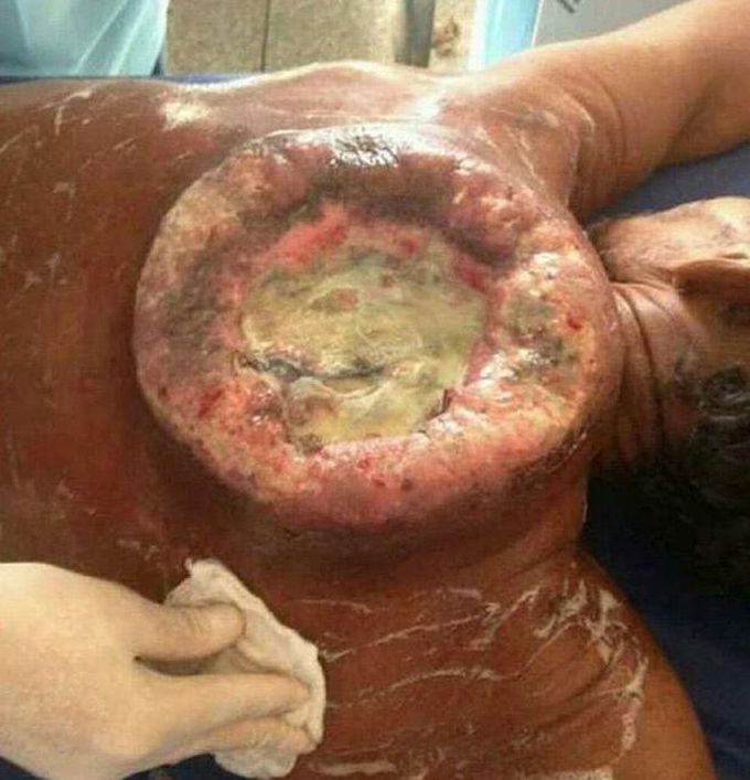 What is the name of this condition