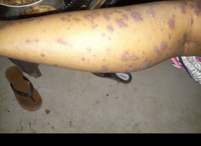 dermatology