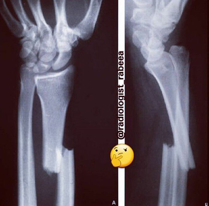 What is diagnosis?
