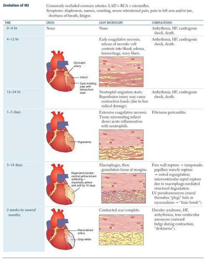Evolution of Myocardial Infarction