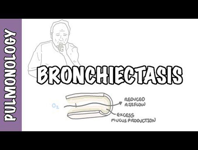 Bronchiectasis - causes, pathophysiology, signs and symptoms, investigations and treatment