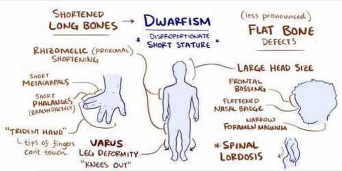 Achondroplasia symptoms