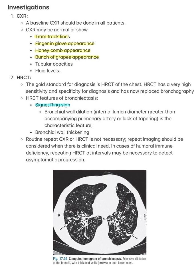 Bronchiectasis V