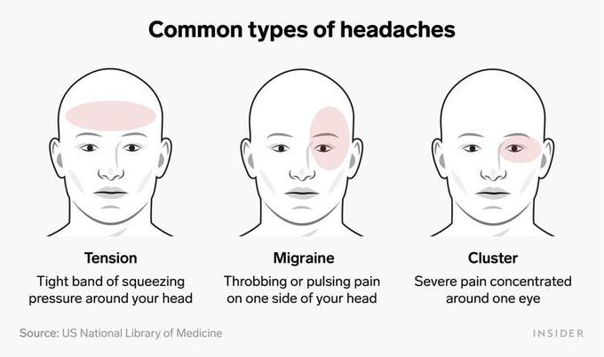 Types of Headaches