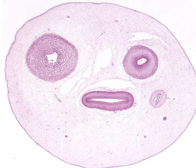 Our face wen trying to understand HISTO SLIDES