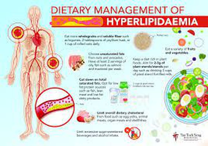 Treatment of hyperlipidemia